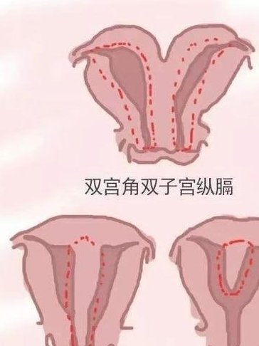 石家庄三代试管生育孩子费用概览：了解真实花费！