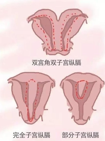 绍兴试管婴儿医院哪里正规，绍兴试管婴儿医院哪里正规
