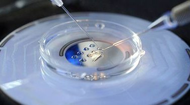 高龄做试管有什么困难？如何保证做试管婴儿？