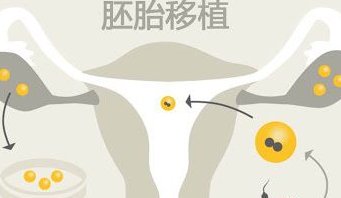 河南省人民医院洗精费用多少钱？试管婴儿移植成功后检查流程有哪些？